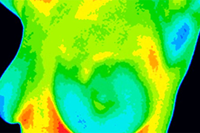 Thermal Camera